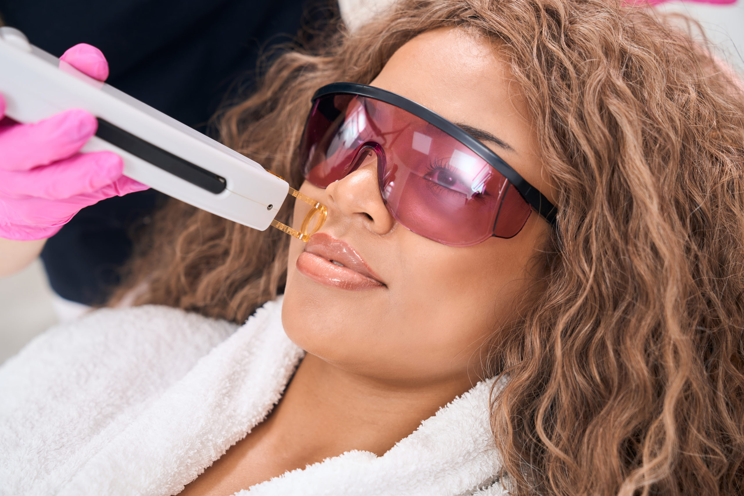 Woman on mustache laser hair removal procedure